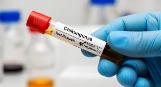 chikingunya